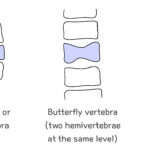 [doctormodu]1 block vertebra