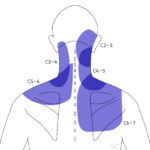 [doctormodu]2 facetogenic pain