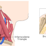 [doctormodu]2 interscalne triangle