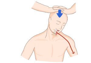 06 경추추간판질환(cervical disc disease)