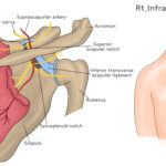 [doctormodu]1 suprascapular n entrapment