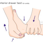 [doctormodu]1 anterior drawer test ankle