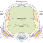 [doctormodu]1 radial sigittal band injury