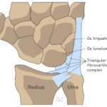 [doctormodu]1 TFCC anatomy