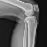 [doctormodu]1 fabella X-ray