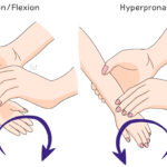 [doctormodu]1 pulled elbow reduction.