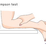 [doctormodu]1 thompson test