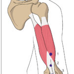 [doctormodu]1 triceps points
