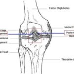 [doctormodu]1 십자인대 anatomy