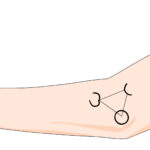 [doctormodu[2 elbow injection
