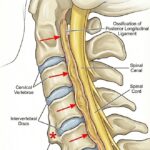 [doctormodu]3 OPLL illustration