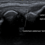 [doctormodu]5 LE ultrasound